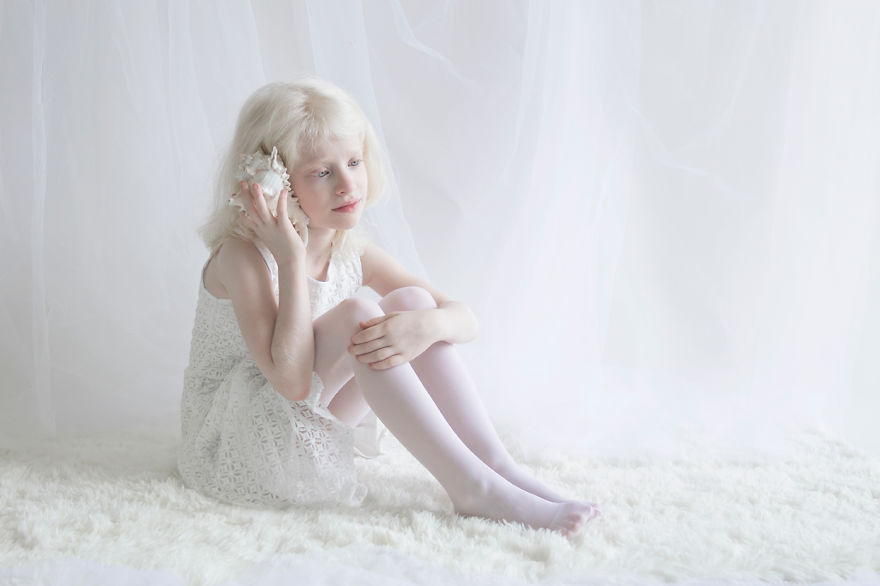 Porcelain Beauty The Hypnotizing Beauty Of Albino People Captured By Yulia Taits 1