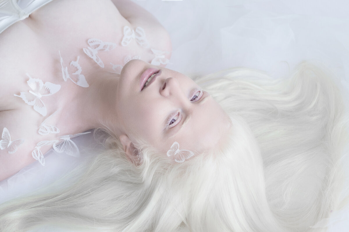 Porcelain Beauty The Hypnotizing Beauty Of Albino People Captured By Yulia Taits (11)