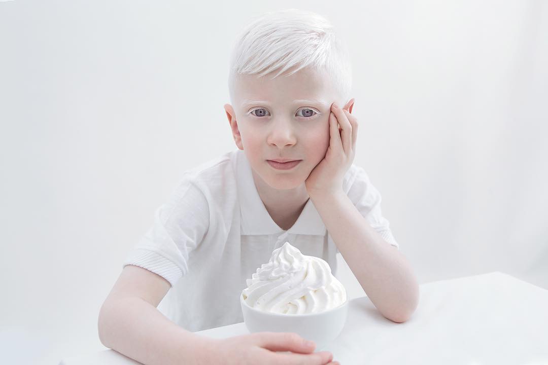 Porcelain Beauty The Hypnotizing Beauty Of Albino People Captured By Yulia Taits 14