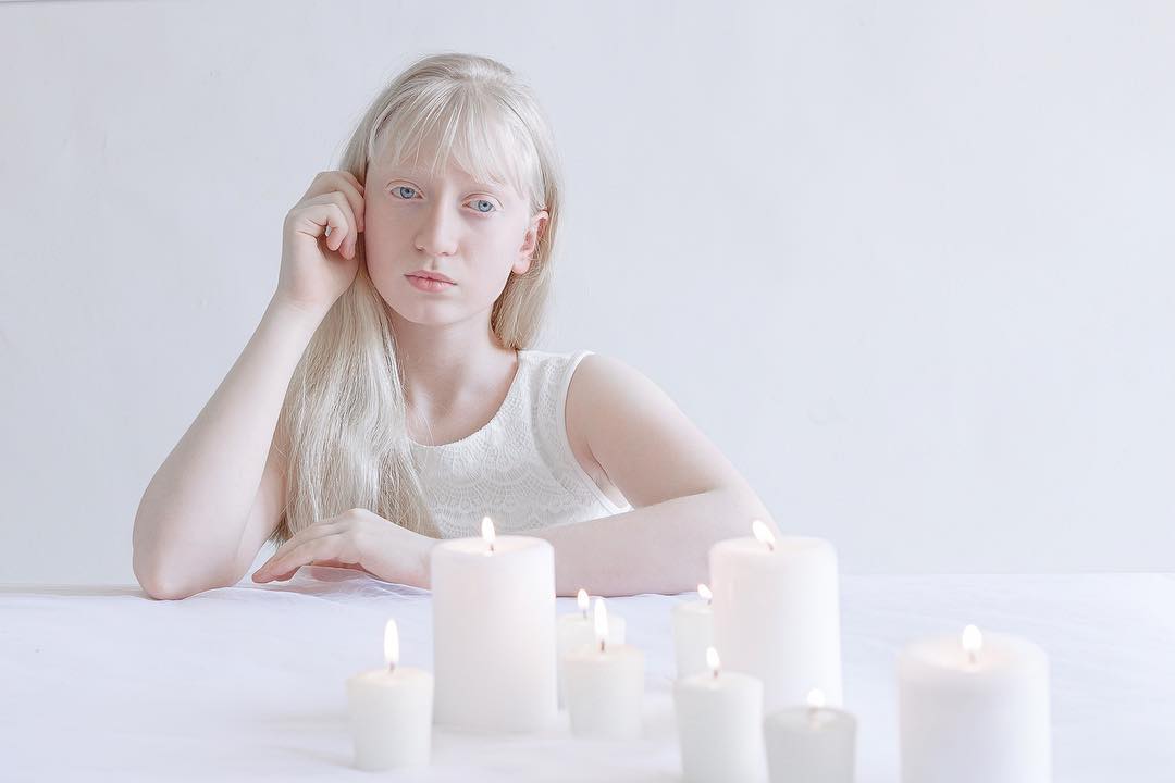 Porcelain Beauty The Hypnotizing Beauty Of Albino People Captured By Yulia Taits 16