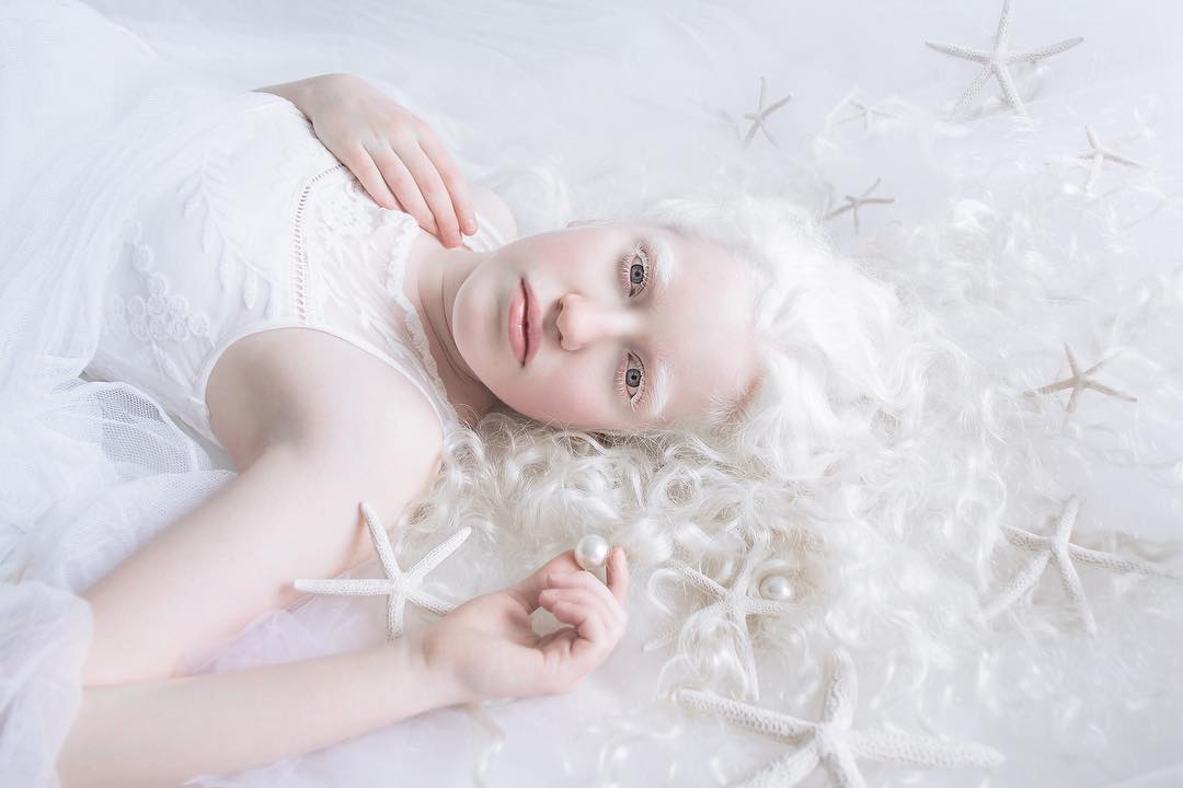 Porcelain Beauty The Hypnotizing Beauty Of Albino People Captured By Yulia Taits 17