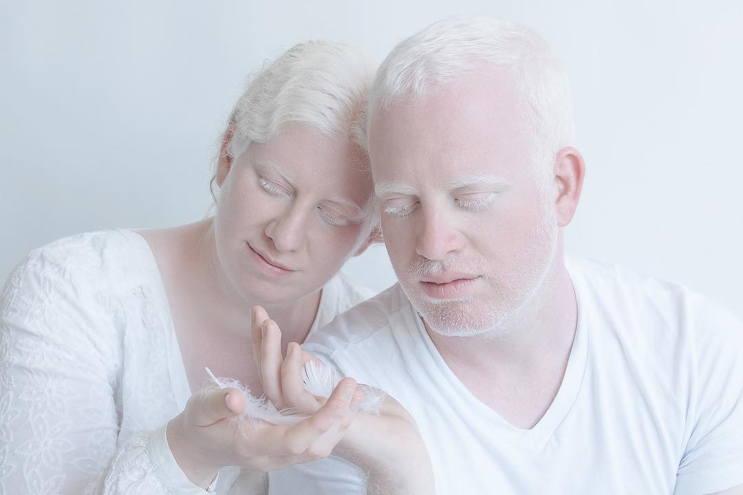 Porcelain Beauty The Hypnotizing Beauty Of Albino People Captured By Yulia Taits 18
