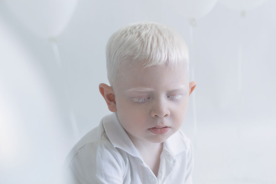 Porcelain Beauty The Hypnotizing Beauty Of Albino People Captured By Yulia Taits 7