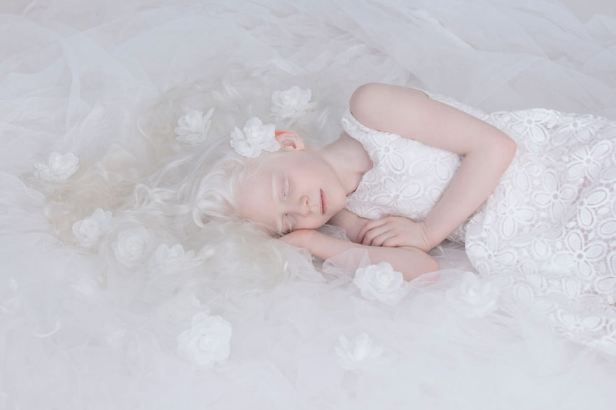 Porcelain Beauty The Hypnotizing Beauty Of Albino People Captured By Yulia Taits 9